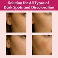 thumbnail image 4 of Crema Facial Roseblem con Arbutina 7% y Ácido Tranexámico 4% 50 g, 4 of 9