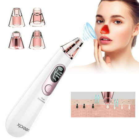 Blackhead Remover Vacuum Pore Cleaner,USB Rechargeable Facial White Head Pore Suction,XPREEN 4 in 1 LED Display Acne Comedone Extractor Kit All Skin Treatment for Women and (Best Blackhead Remover For Men)