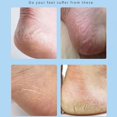thumbnail image 4 of Foot File Callus Remover Foot Scrubber,Professional Pedicure Foot Rasp Removes Cracked Heels,Dead Skin,Corn,Hard Skin,Pumice Stone for Scraper File Brush Tools for Wet and Dry Feet(1PC), 4 of 8