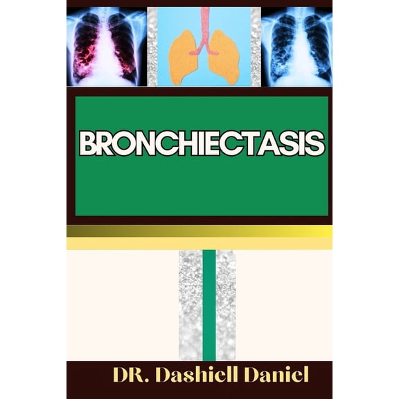 Bronchiectasis: Expert Guide to bronchiectasis Causes, Symptoms, Treatment, and Achieving Complete Wellness (Paperback)
