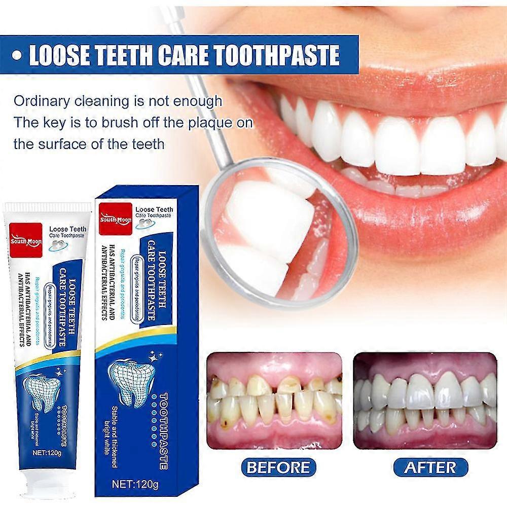 Mint Toothpaste Clean Gingival Tooth Fixation Toothpaste Curing Teeth ...