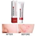 thumbnail image 3 of 5 Cremas Hidratantes Para Pecas, Crema Reparadora Para Melasma, Manchas Oscuras, Hidratantes 5 piezas, 3 of 8