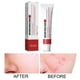 thumbnail image 3 of Crema Para Pecas, Crema Hidratante Reparadora Para Melasma, Manchas Oscuras, Hidratante Yuyangstore Cara Peca Nutritiva, 3 of 8