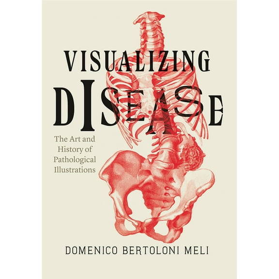 Visualizing Disease : The Art and History of Pathological Illustrations (Hardcover)