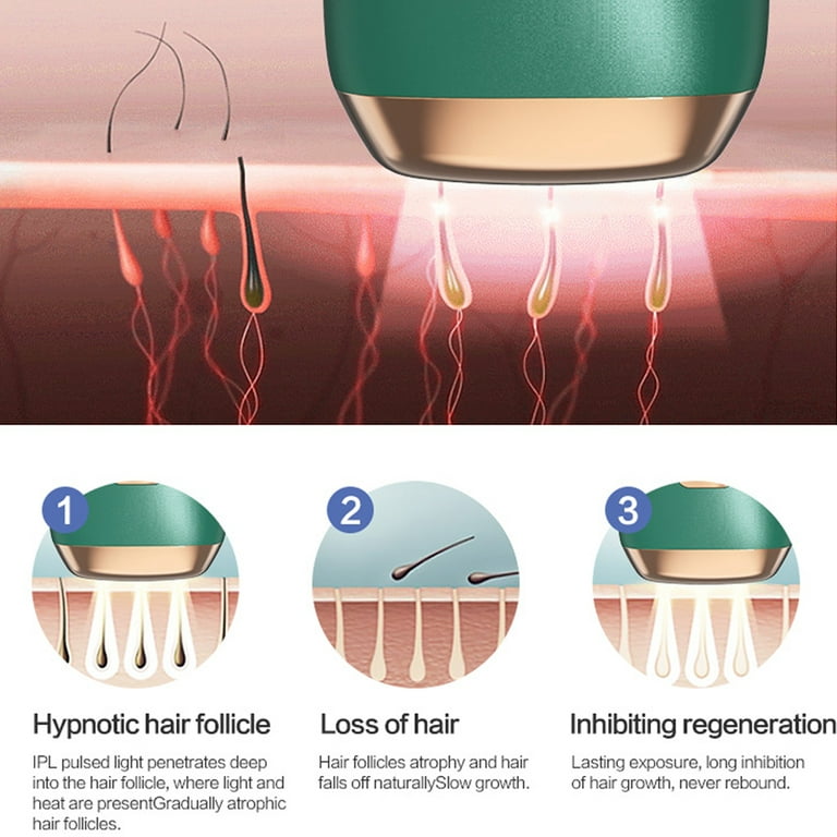 Laser Hair Removal for Women and Men,Depilacion laser，IPL Hair
