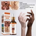 thumbnail image 3 of Suero Blanqueador Aceite Aclarante para Manchas Oscuras en Cuerpo y Nudillos Piel Negra Rodillas y C, 3 of 7