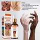 thumbnail image 3 of Suero Blanqueador Aceite Aclarante para Manchas Oscuras en Cuerpo y Nudillos Piel Negra Rodillas y C, 3 of 7