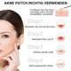 thumbnail image 5 of Rewera 216 Dots - Parche invisible para el acné y las espinillas, parche para el acné, tratamiento para cicatrices faciales, pegatinas (6 hojas), 5 of 5
