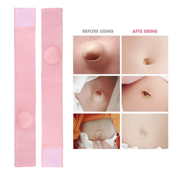 2 Pcs Ceinture pour Hernie Bebe Enfant Ceinture pour Hernie Ombilicale Soutien Abdominal Attelle Bandage Nombril Ceinture pour Hernie Ombilicale Bebe Ceinture pour Hernie Ombilicale Bebe Walmart