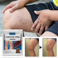 thumbnail image 4 of JAYSUING 12Pcs Varicose Veins Patches Skin-friendly Non-toxic Improve Varicosity Dredge Vein Relieve 26-27s, 4 of 5