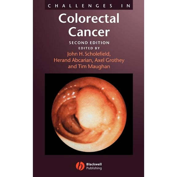 Challenges in Colorectal Cancer, (Hardcover)