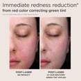 thumbnail image 4 of Protector solar EltaMD UV Skin Recovery SPF 50 para piel sensible, 4 of 7