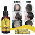 thumbnail image 4 of Hair Growth Essence Hair Loss Scalp Treatments Ginger Ginseng, 4 of 4