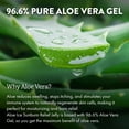 thumbnail image 3 of Gel de aloe vera Aloe Up para aliviar las quemaduras solares, 120 ml, 96,6%, gel puro, 3 of 6