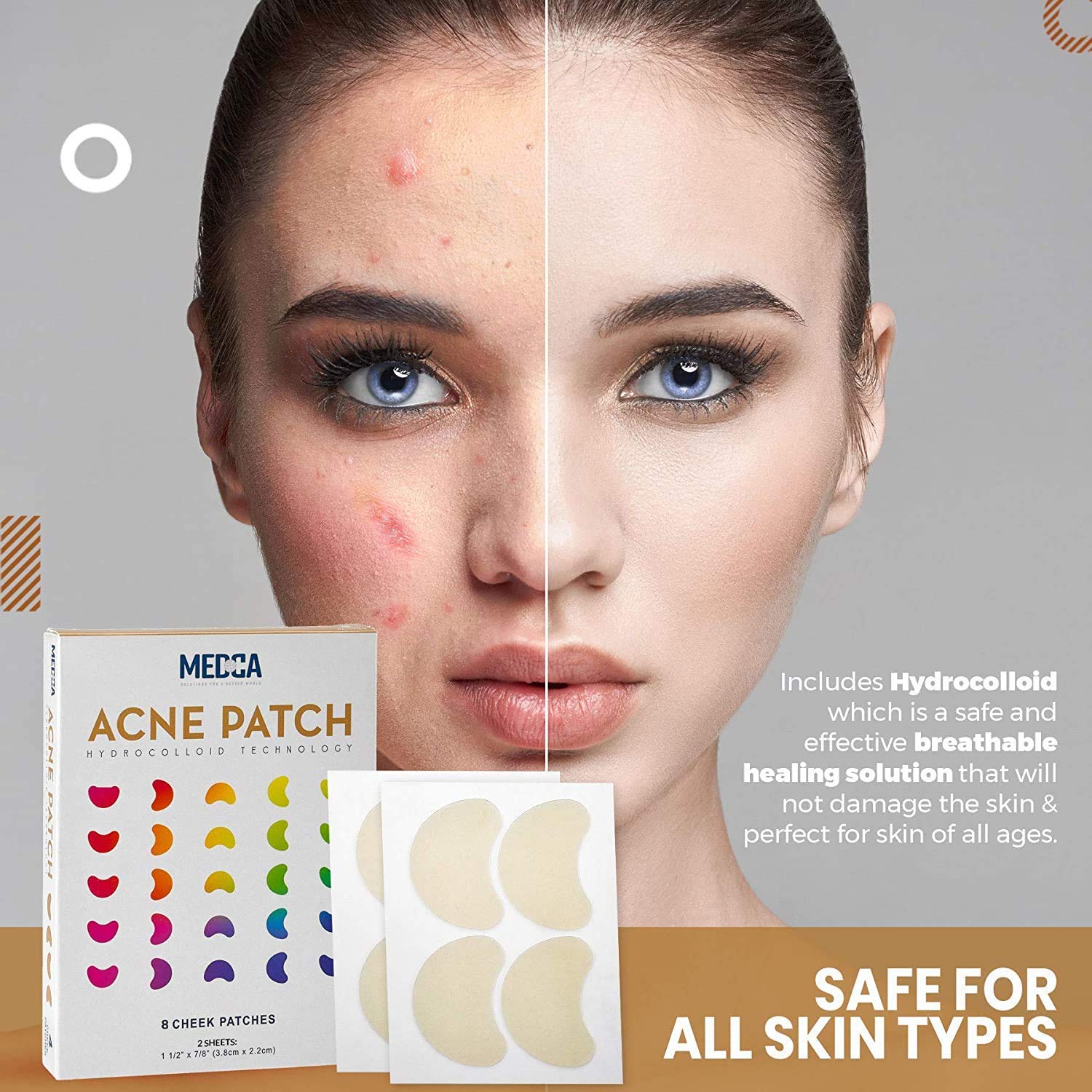 2 Gels Traitants OXY Post-acné - Anti-taches Et Marques, 18g, Date Valide +1 An