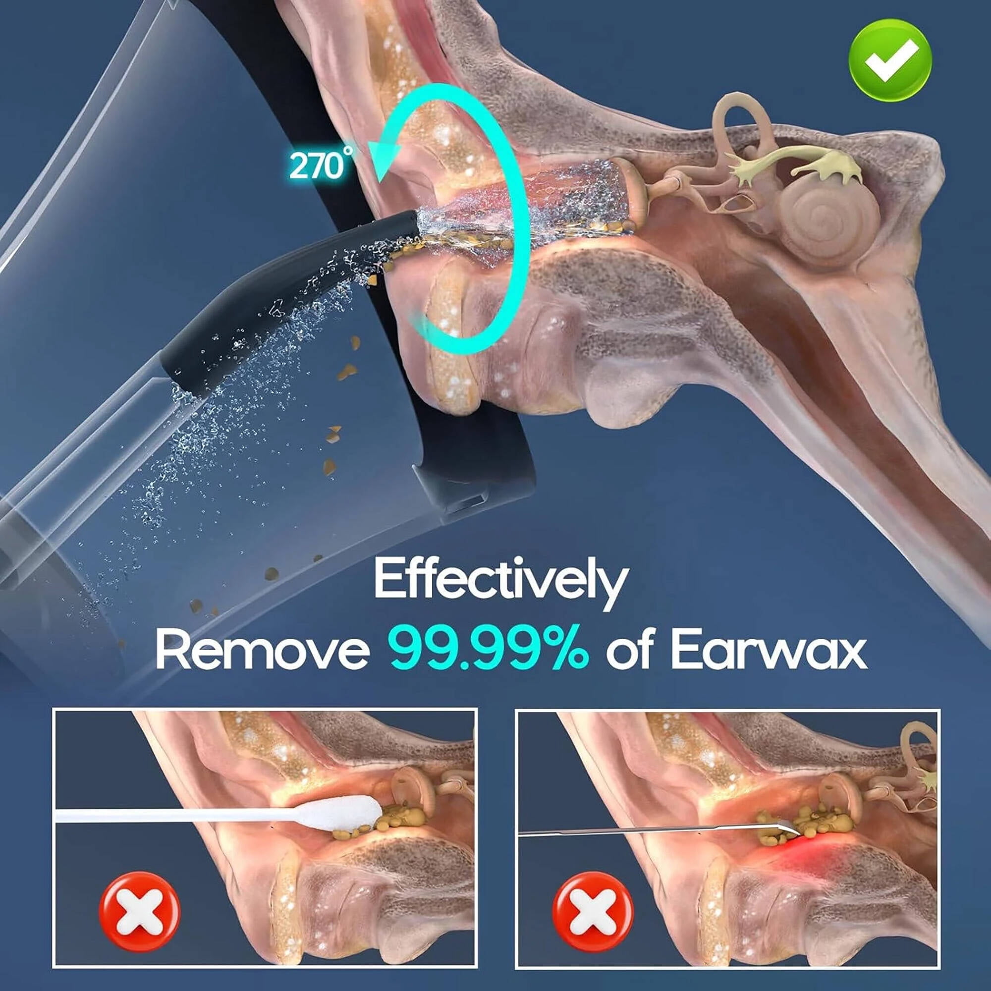 Morfone Ear Wax Removal with One-Piece Waste Tank, Ear Cleaner with Water Temperature Sensor, 4 Pressure Settings, Ear Cleaning Kit for Ear Wax Buildup & USB-C Cable, IPX6, Black
