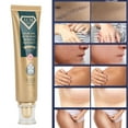 thumbnail image 1 of Scar Removal Cream, Scar Remover No Stimulation Safe Refreshing  For All Types Of Scars, 1 of 8