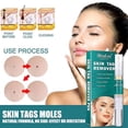 thumbnail image 4 of Crema De Tratamiento Para Eliminar Verrugas Y Lunares, 5 Ml, Para El Cuidado Facial, Bolígrafo Natural Para Eliminar Verrugas Y Lunares, 4 of 4
