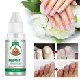 thumbnail image 2 of Professional Nails Repair Essence Nail Renewal Liquid Nail Fungus Treatments, 2 of 5
