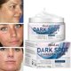 thumbnail image 3 of IBeaLee Facial Spot Removal Cream Whitens, Lightens, Fades, Stains, Acne Marks Improves Darkness, 3 of 5