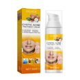 thumbnail image 2 of Pimples Nourishing, Pimples Cream Gently ,Brightens Facial Skin Pimples Treatment,Salicylic Skin Nourishing Removal,Shrink Pores Face Care Pimples Salvador Dali Espinillas Nutritivo, 2 of 5