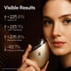 thumbnail image 2 of INIA Terapia de Luz Roja 7 en 1 para Rostro y Cuello - Masajeador Facial Gua Sha con Modos Térmico y Crioterapia para Desinflamar y Reafirmar, 2 of 8