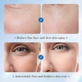 thumbnail image 4 of Hyaluronic Acid Serum Microneedling Serum For Face, Hyaluronic Acid Anti-aging Repair Serum, Ceramide Ampoule Serum with Hyaluronic Acid, 4 of 5