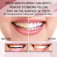thumbnail image 5 of Fruit Breath Spray, Compact Portable Refreshing Cool Breath Oral Odor Care, Refreshing Cool Breath Oral Odor Care (MIX), 5 of 7
