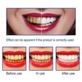2 Pack Teeth Whitening Gel 44 Carbamide PeroxideQuick Whitening