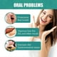 thumbnail image 5 of Bad Breath Removing Drops - Fresh Breath Professional Formula Oral Care Essence--, 5 of 5