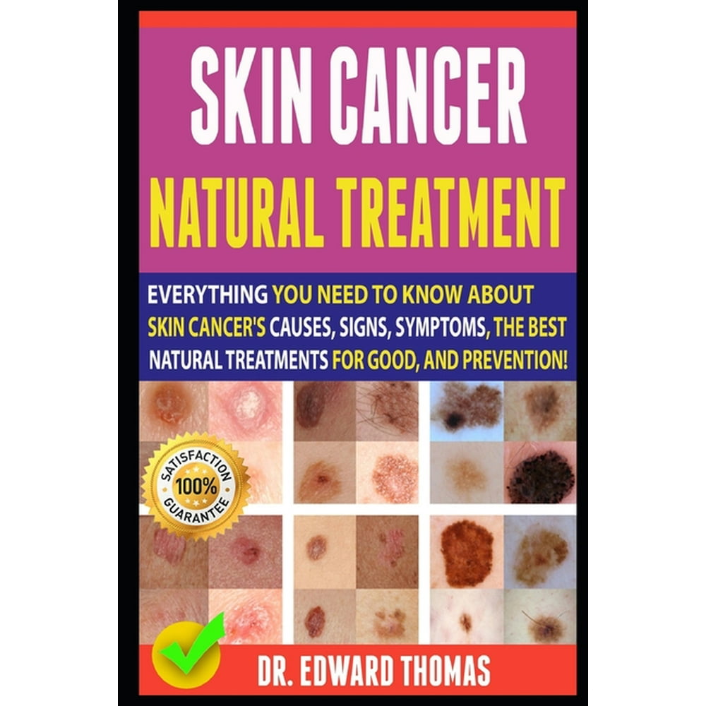 Skin Cancer Natural Treatment Everything You Need To Know About Skin Cancer's Causes, Signs