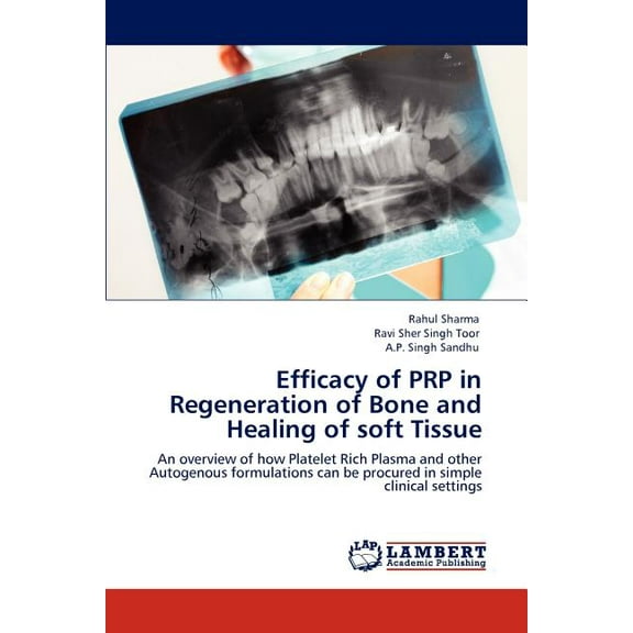 Efficacy of Prp in Regeneration of Bone and Healing of Soft Tissue (Paperback)