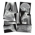 thumbnail image 5 of Roylco Broken Bones X-Rays – Human Skeletal Fracture X-Ray Set for STEM/STEAM Anatomy Lessons, Light Table Viewing & Hands-On Science Learning, 5 of 5