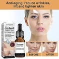 thumbnail image 4 of Jaysuing Face Serum Wrinkles Remover Anti-Aging Fade Fine Lines Serum Whiten, 4 of 5