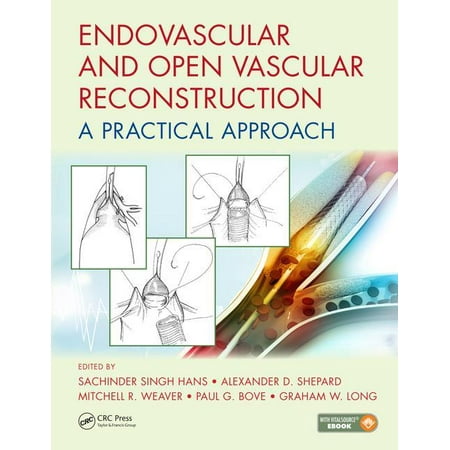 UPC: 9781498760553 | Endovascular and Open Vascular Reconstruction: A Practical Approach (Hardcover)