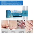 thumbnail image 4 of Bolígrafo para Reparación de Uñas Zulema 4 Uds 3ml Gel Aclarador, 4 of 8