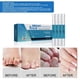 thumbnail image 4 of Bolígrafo para reparación de uñas, 4 Uds., 3ml y alrededor de , antihongos para grietas de uñas, promueve la Yinane gel aclarador de uñas, 4 of 8