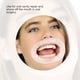 thumbnail image 2 of Retractor de mejillas ANGGREK 10 Uds Abridor de boca de goma desechable mordaza Dental herramientas de dentista Oral, 2 of 8