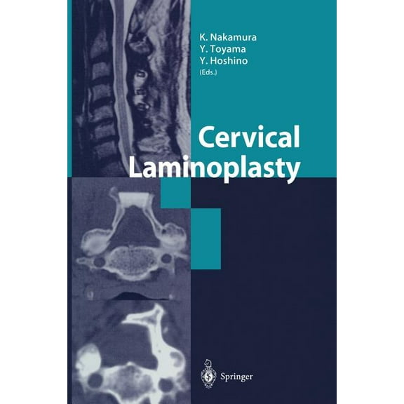 Cervical Laminoplasty, (Paperback)