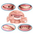 thumbnail image 4 of Women Fashion Upper And Lower Teeth Simulation Denture Set Second Generation Silicone Simulation Denture Set, 4 of 5