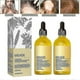 thumbnail image 1 of 1-3pcs New Natural Hair Growth Oil, Veganic Natural Hair Growth Oil 60ml, 1 of 4