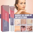 thumbnail image 1 of ¡Precio rebajado! Eliminación De Lunares Ungüento Verrugas Ungüento Manos Y Pies Crema Eliminación De La Cara Axilas Gránulos De Carne Cuello Piel Limpia Eliminación De Lunares,20g Por Un Período Limi, 1 of 4