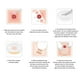 thumbnail image 4 of Bolsas De Ostomía De Una Pieza, Bolsa De Colostomía Con Filtro De Carbón Activado Desechable Que Reduce La Fricción Para El Cuidado Del Estoma, 4 of 7