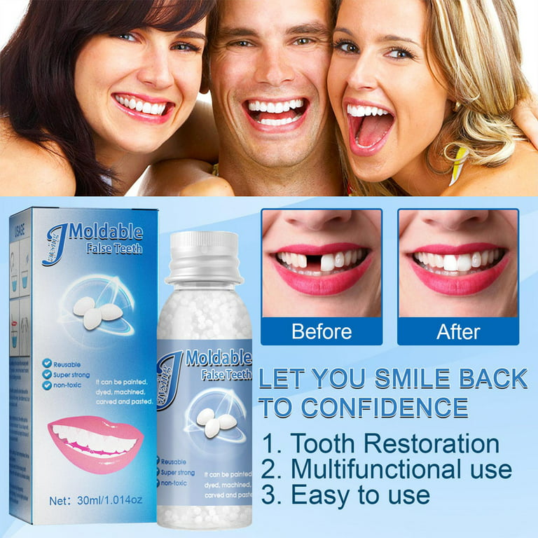 Hiroke Teeth Repair Kit, Temporary False Teeth Moldable False Teeth for  Snap on Instant and Confident Smile 