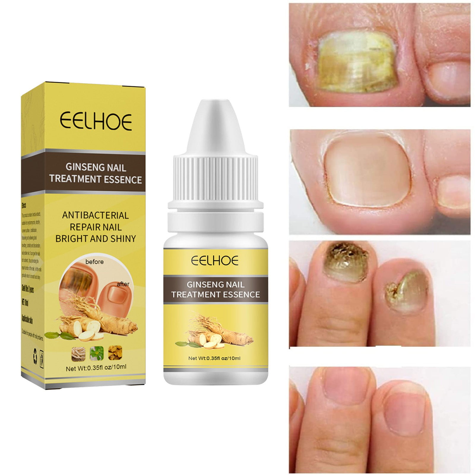 Nail Fungus From Press On Nails