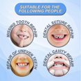 thumbnail image 5 of Kit de reparación de dientes temporales, dentaduras postizas con pegamento sólido para prótesis dentales faltantes o rotas, 5 of 5