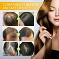 Hair Growth Spray Biotin Hair Growth Serum Biotin Thickening Herbal Hair Growth Spray Biotin Hair Growth Serum Biotin Thickening Herbal
