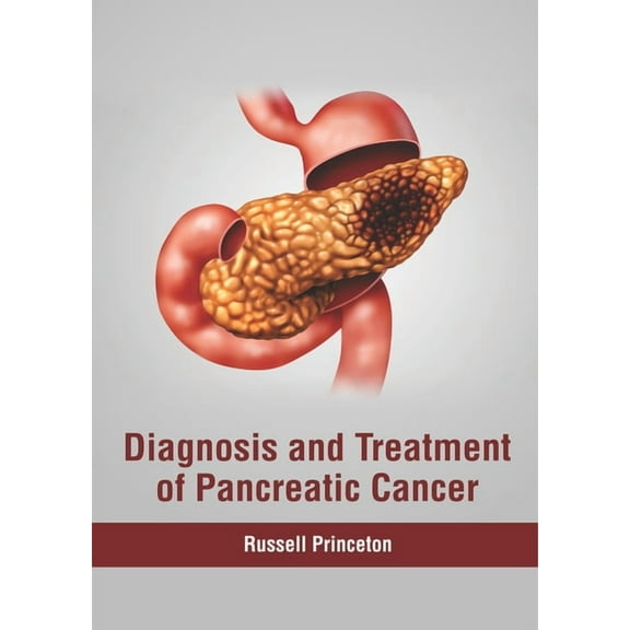Diagnosis and Treatment of Pancreatic Cancer, (Hardcover)
