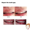 thumbnail image 3 of Advancent Accesorio Dental ajuste seguro dentadura postiza pegamento sólido ajuste cómodo diente temporal pegamento sólido fácil Kits de decoración para fiestas, 3 of 6