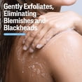 thumbnail image 2 of Cetaphil Daily Use Moisturizing Acne Relief Body Wash, 2% Salicylic Acid, Unscented, 16.9 fl oz, 2 of 10